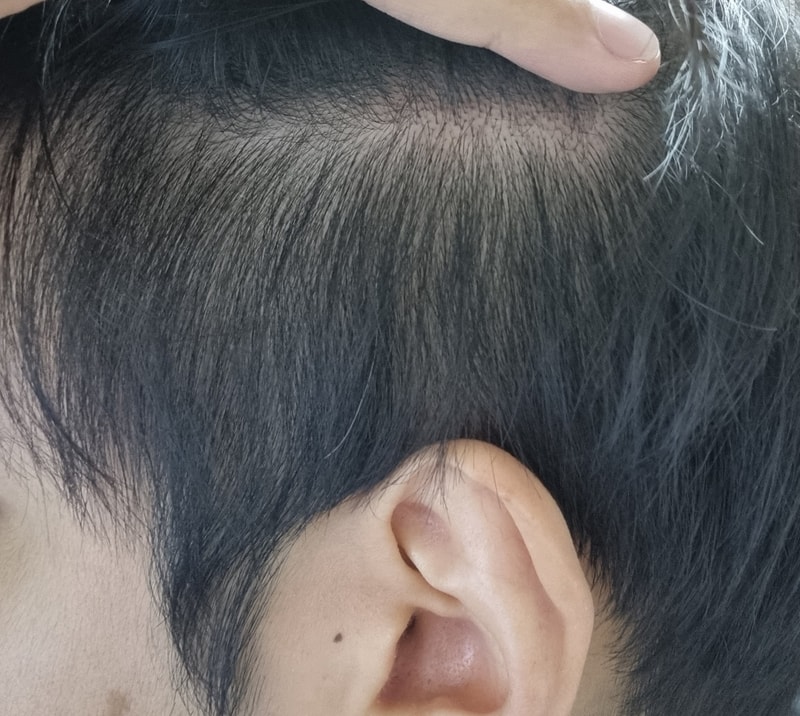 두파탈모이신분 계신가요?