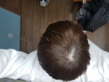 1년전 머리