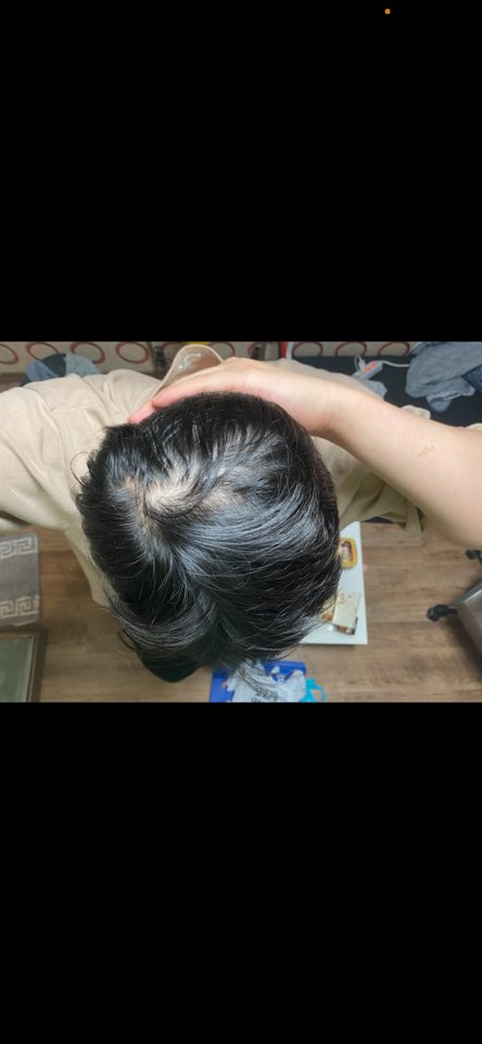 머리 털림 ,,