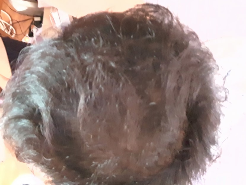 정수리 