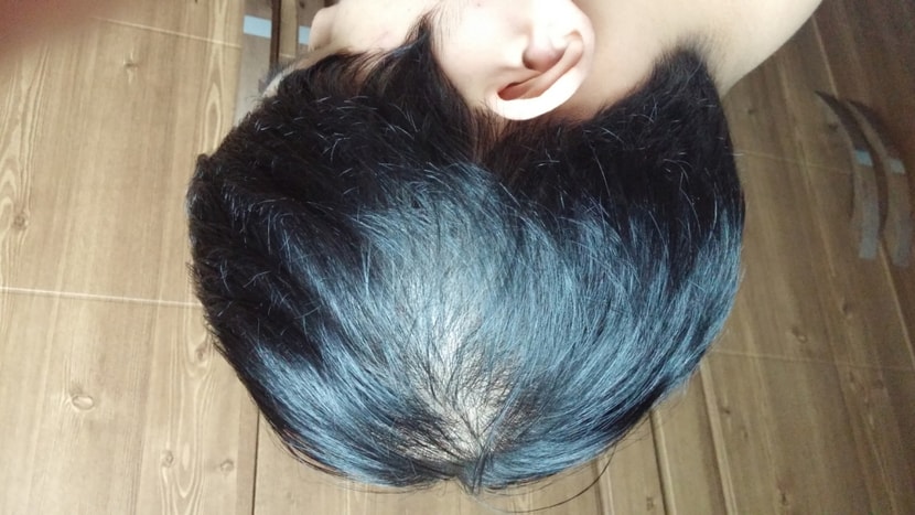 왼쪽