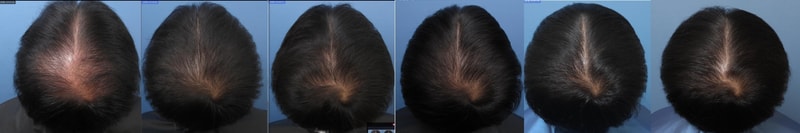 약 15년간의 치료(?)