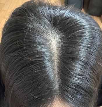 형광등 아래서