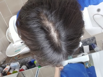 평소 가르마 탓을때