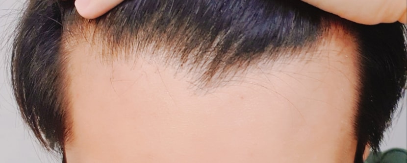 위에서 