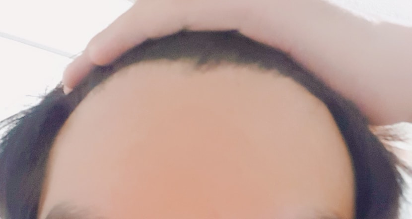 정면
