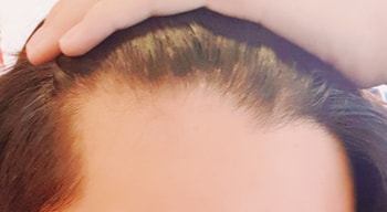 좌측 위에서