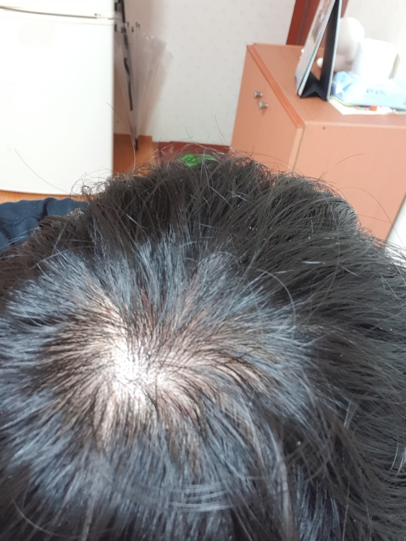 올해 6월 사진입니다. 이 아래는 모두 현재 사진입니다