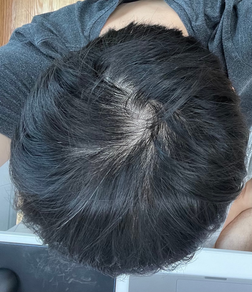 정수리 사진