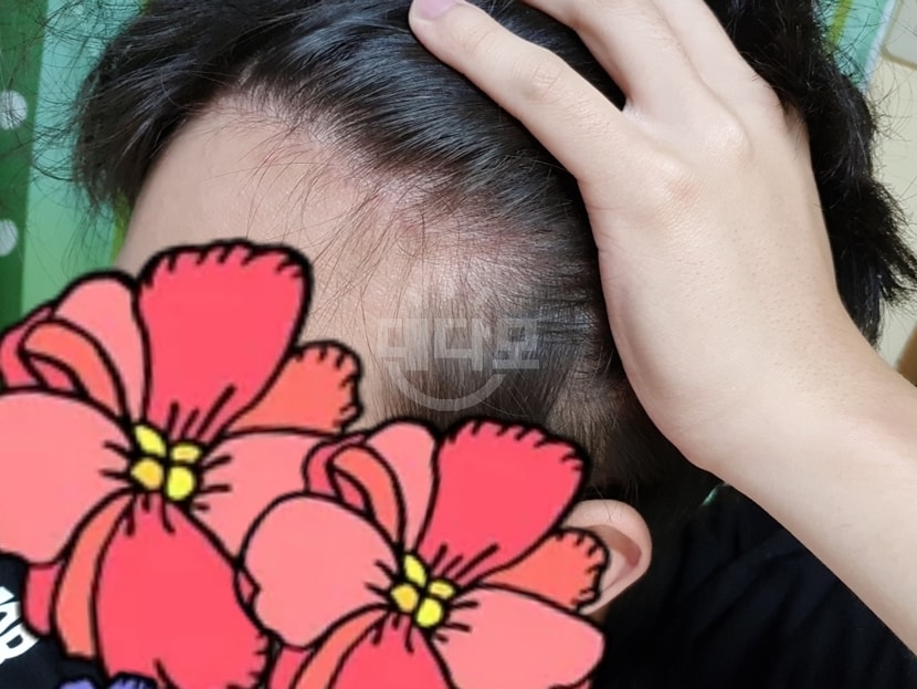 이건 작년 12월에 글썻을때 올린사진입니다 다들 아직 걱정하지 않으셔도된다하셨을때