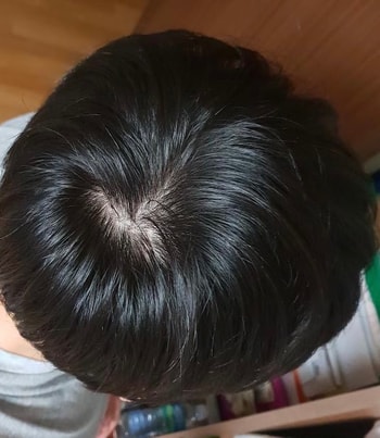 2년전 사진 