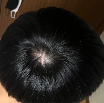 최근, 2년전사진과 비슷한 각도 