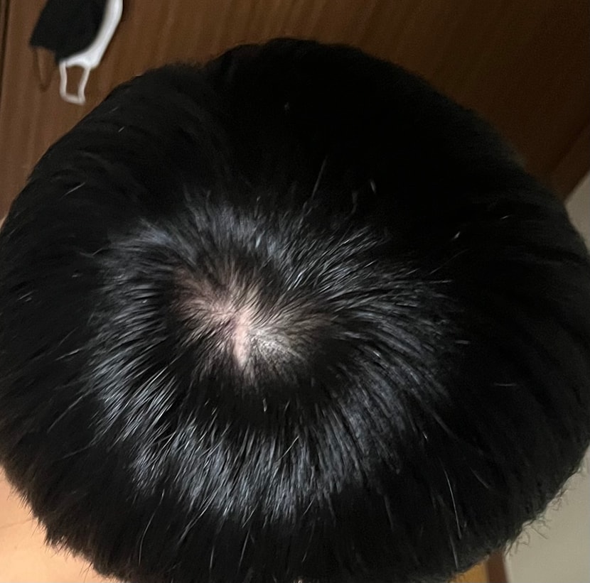 최근, 2년전사진과 비슷한 각도 