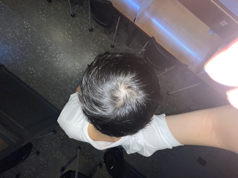 8월, 강한 광원 + 후레시 