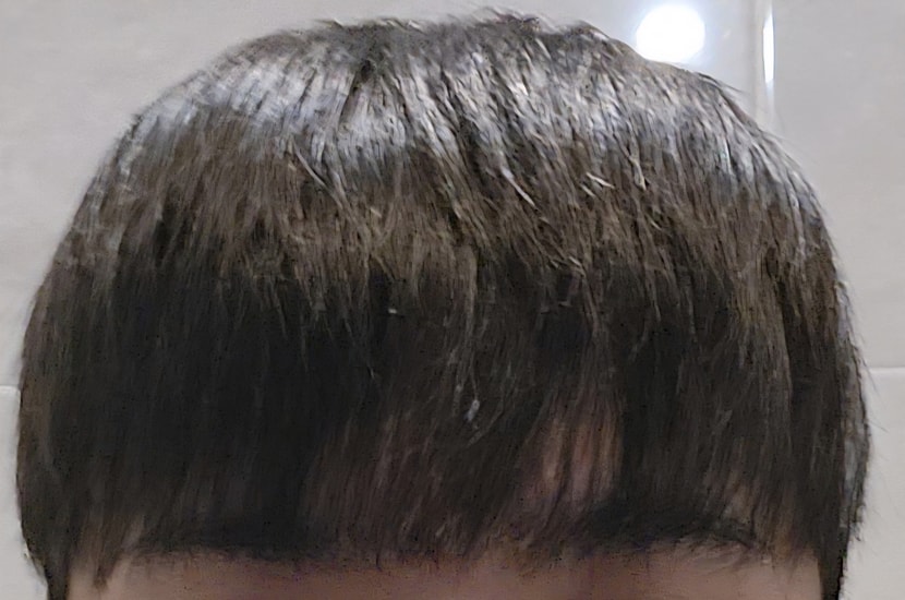 앞머리2