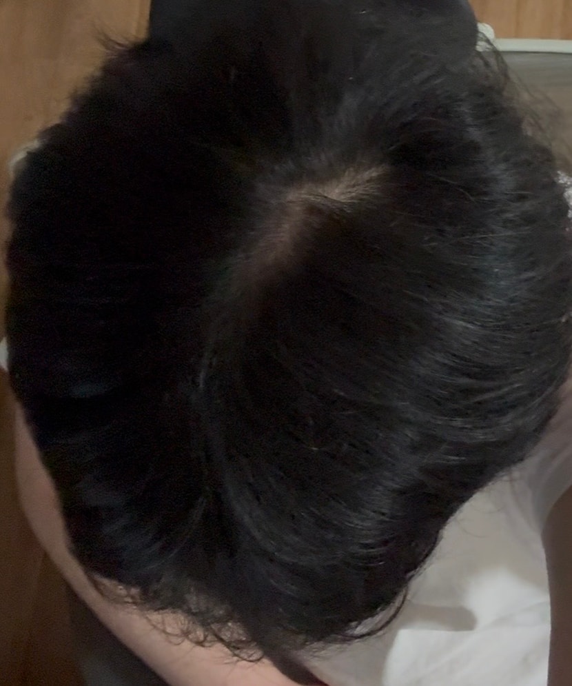 가르마 사진2