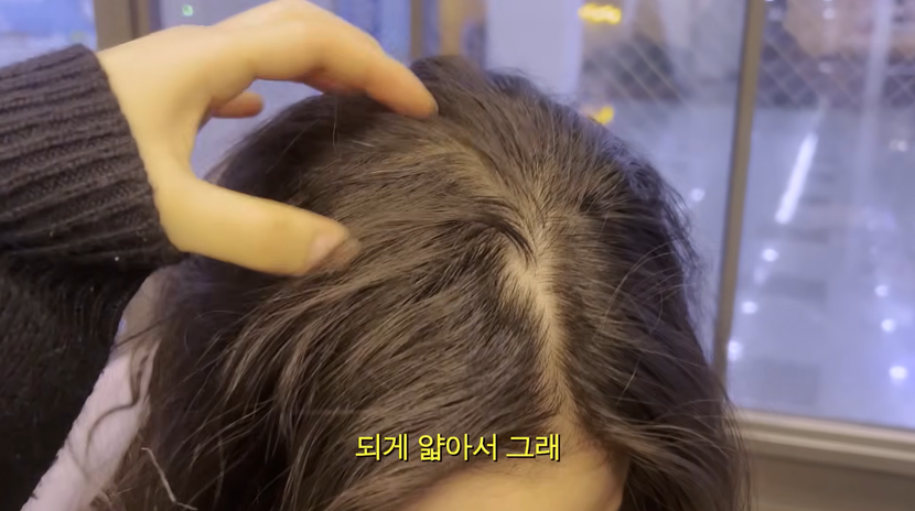 하얗게 비치는 정수리