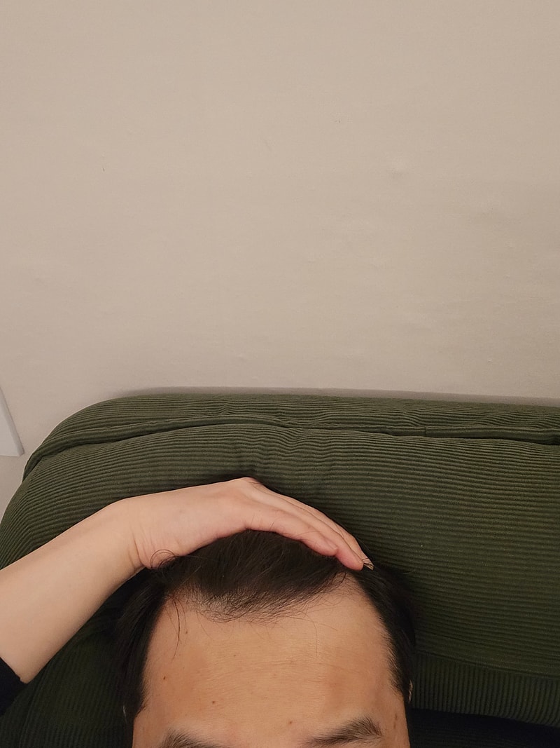 탈모수다