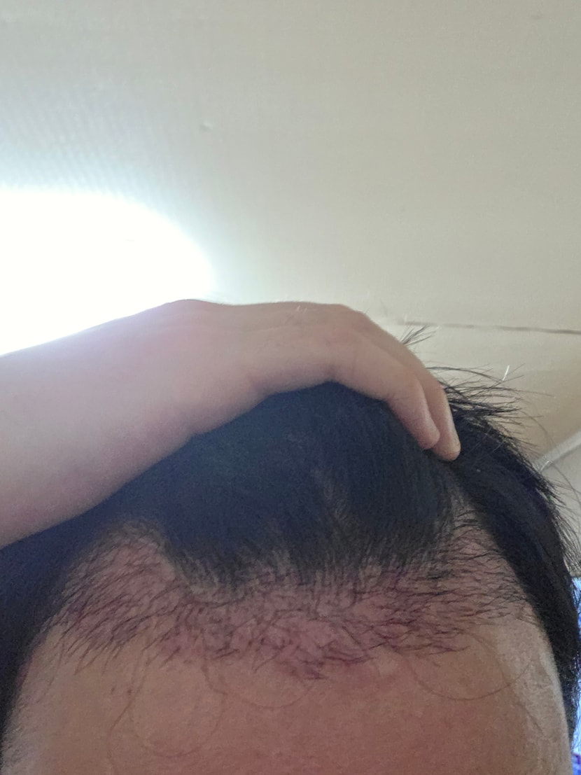 평소에도 이 정도로 빨갰습니다.