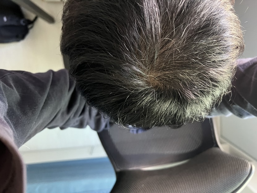 현재
