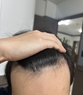 원래 이마가 넓다고 하셨어요