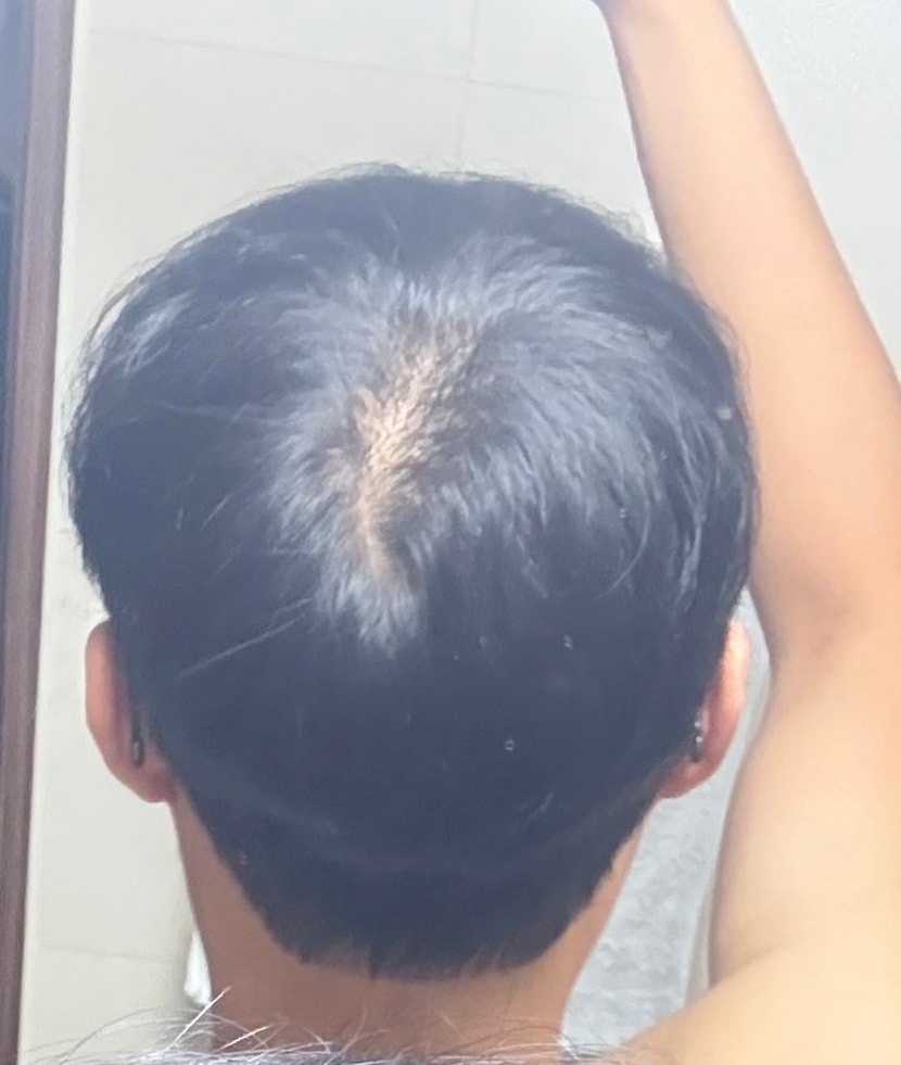 고개 약간 들고 찍은 사진