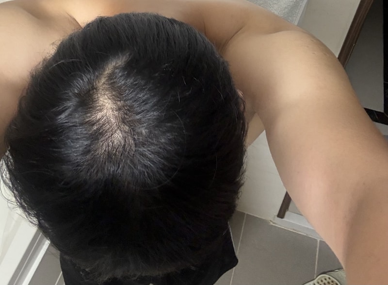 从头顶到侧头到后头