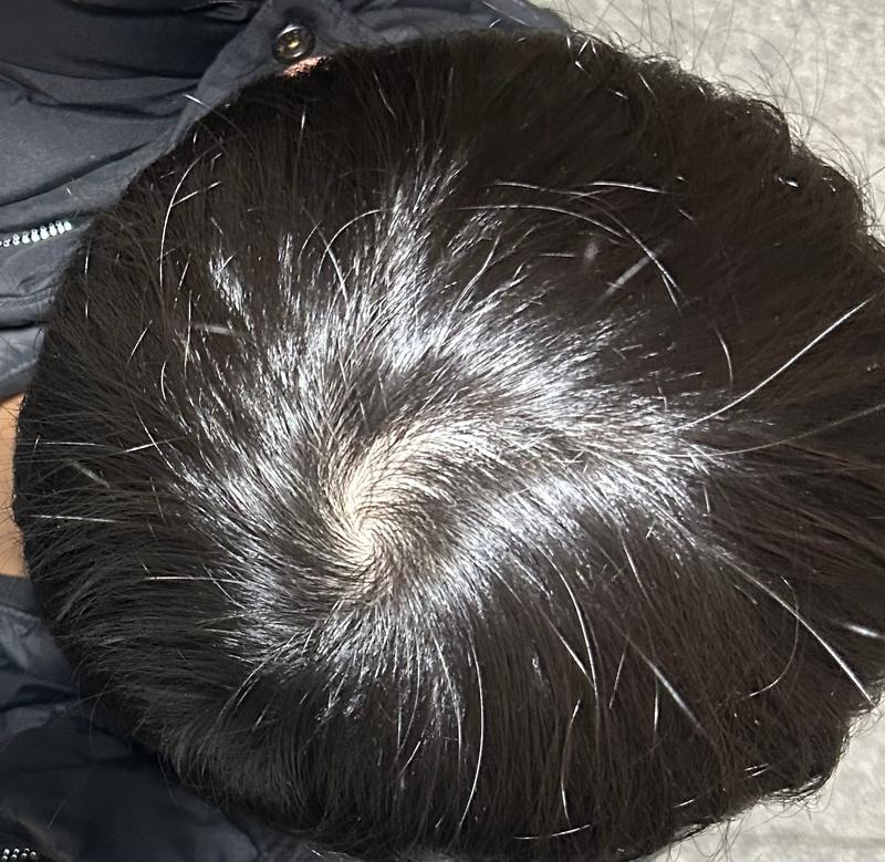 상태 괜찮은건가요..?