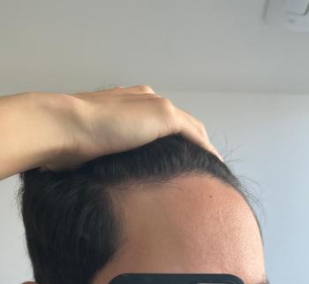약 복용 전 작년 12월