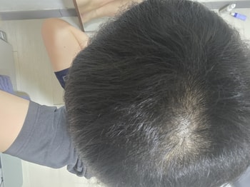 이거 잔털이 올라오는건가요?,
