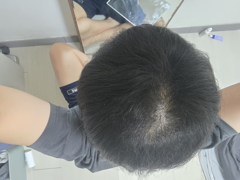 잔털2??