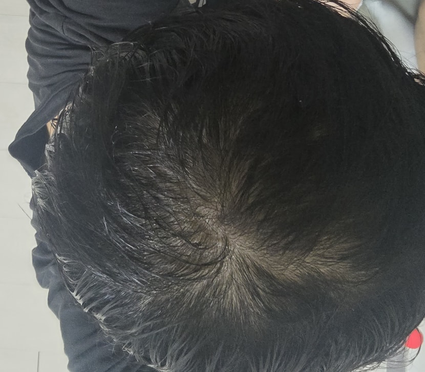 러닝 후 젖은 정수리 고화질