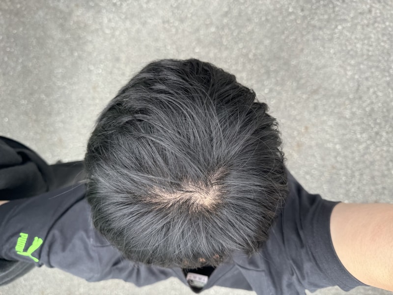 27살 심한가요…