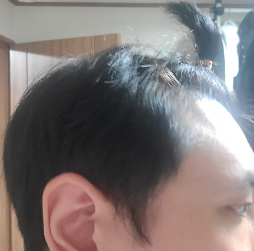 옆머리입니다