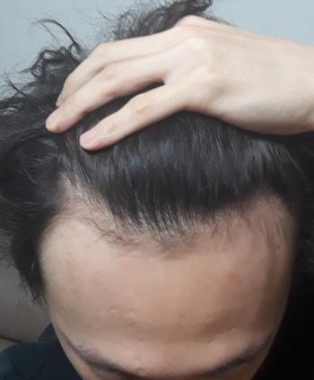 4년전