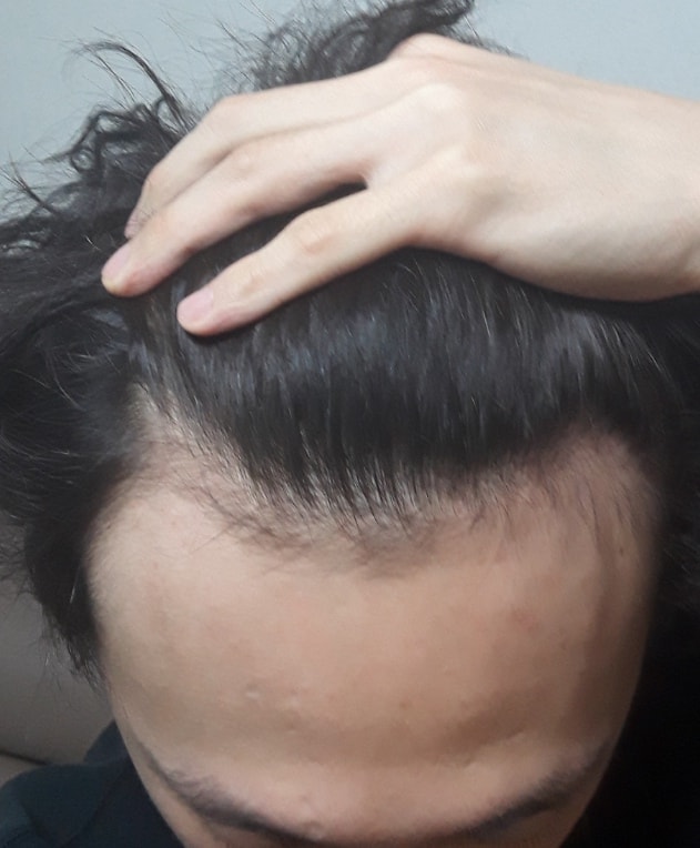 4년전