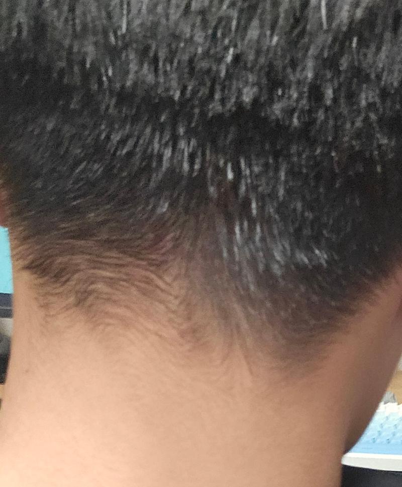 이거 탈모 인가요?