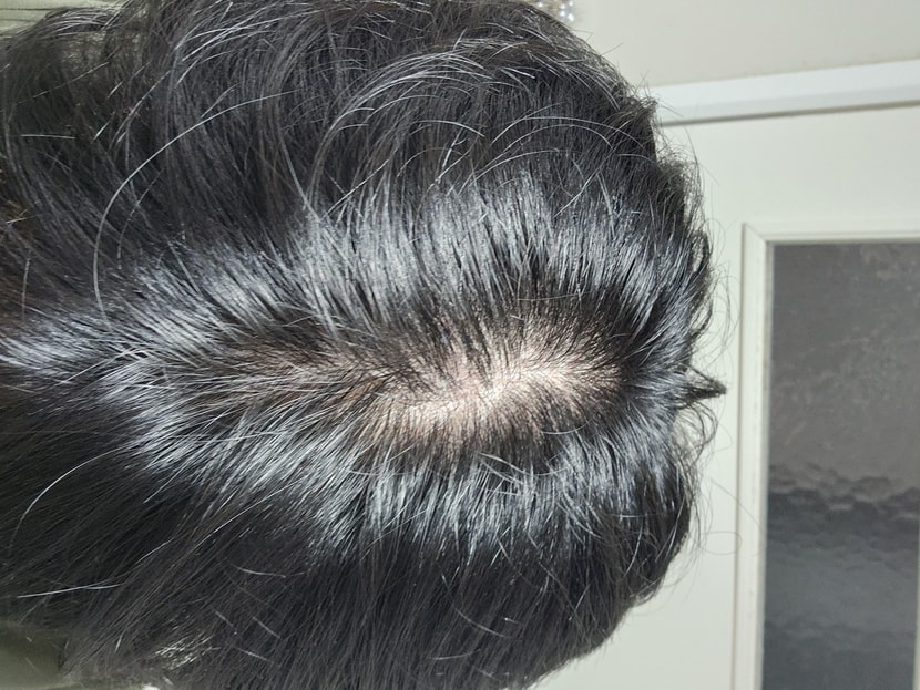 좀 벌리고 빛 아래