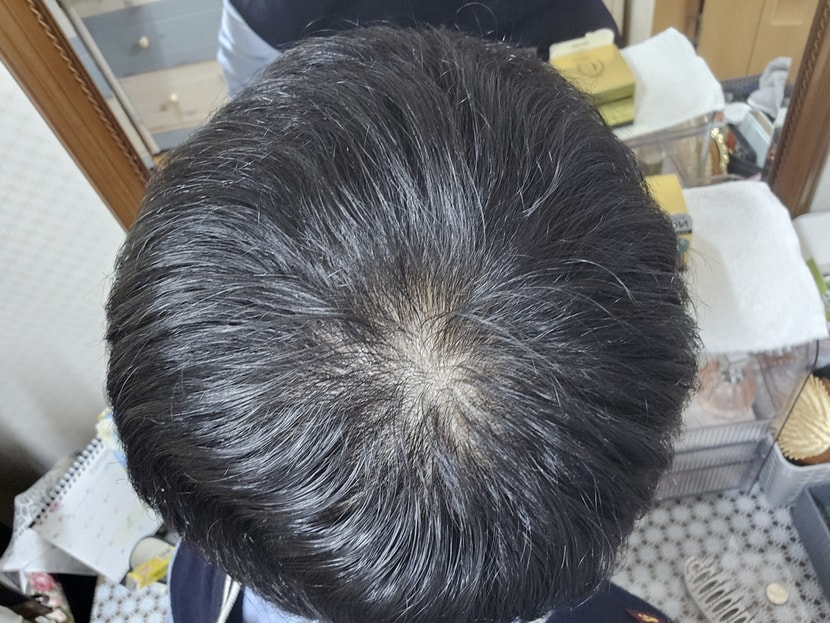 이게 집에서 찍은 사진입니다