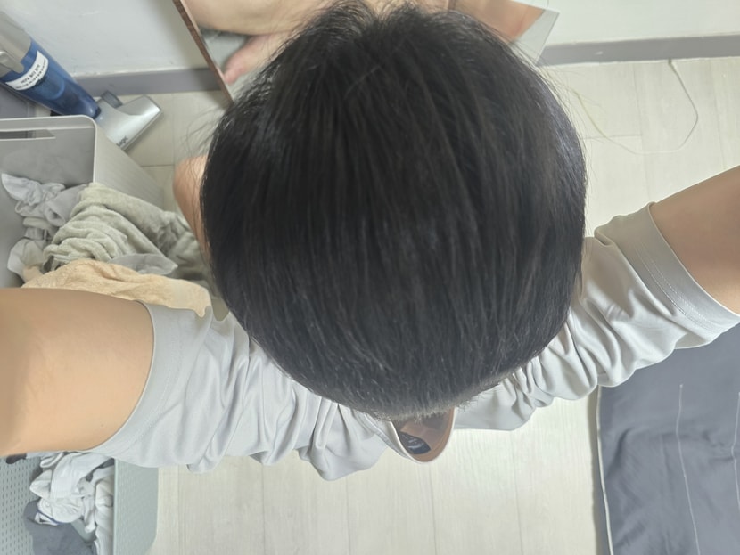 탈모야 오늘은 너를 숨겨주고 싶었어
