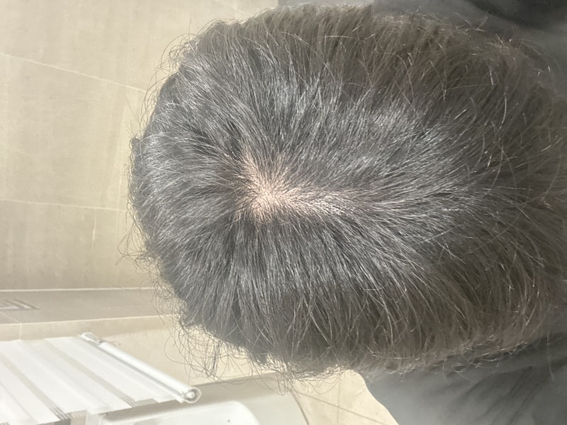 탈모인지 너무 궁금합니다..