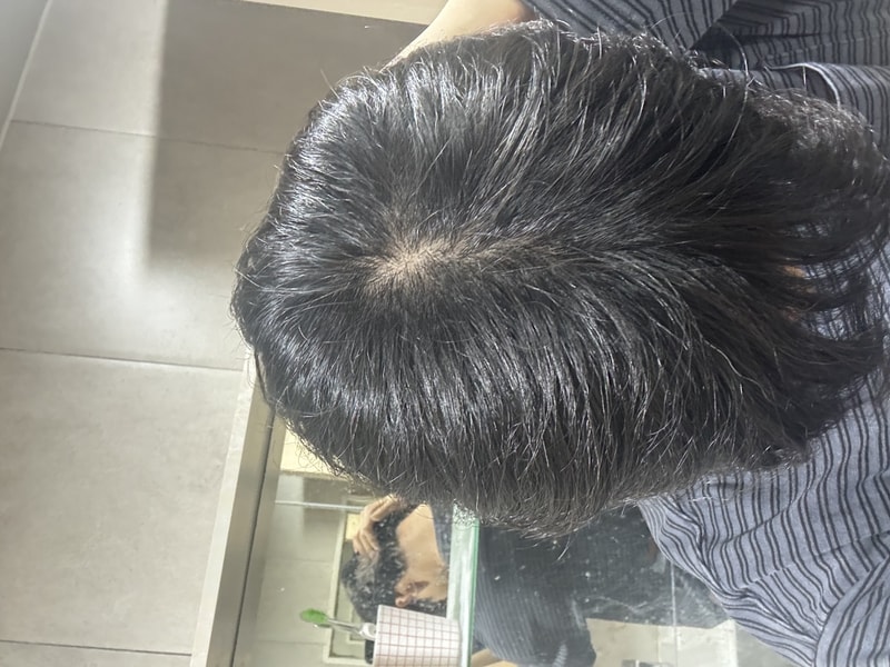 정수리 탈모일까요 너무 죽고 싶네요..