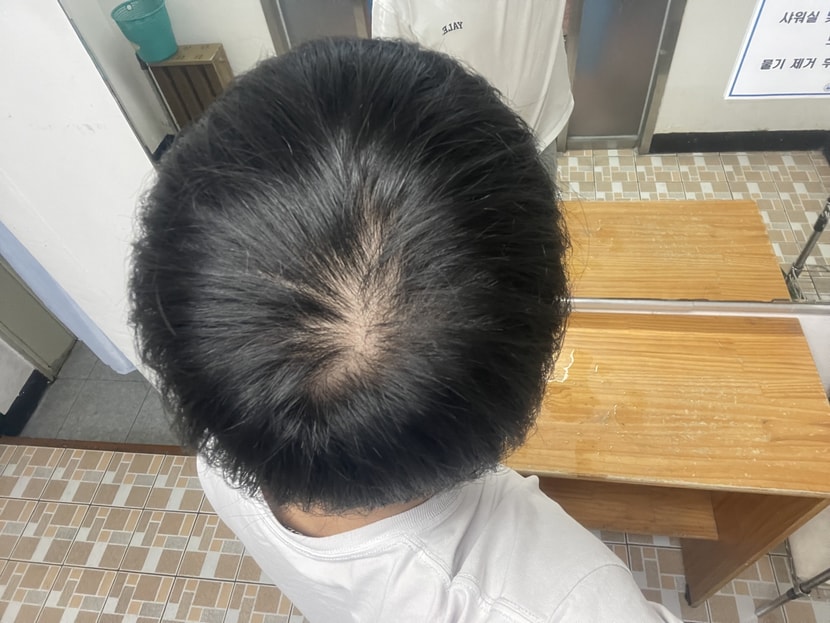 현재 약복용 9개월차1(23년 5월)