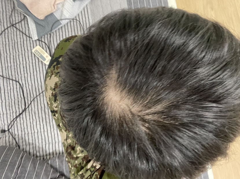 약복용시작2(22년 9월)