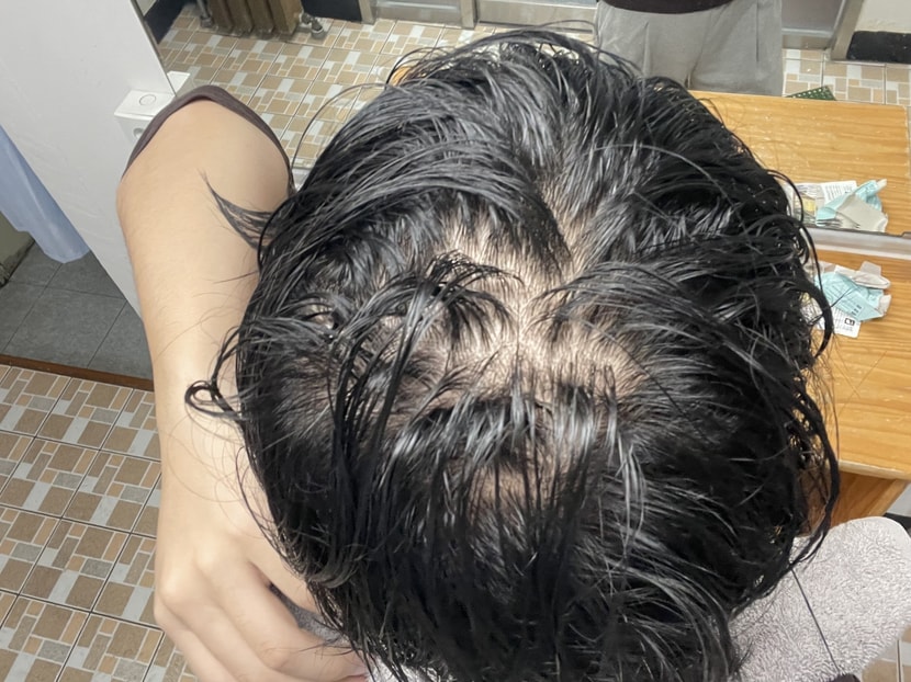 현재 물뭍히고(두파탈모ㅠ)