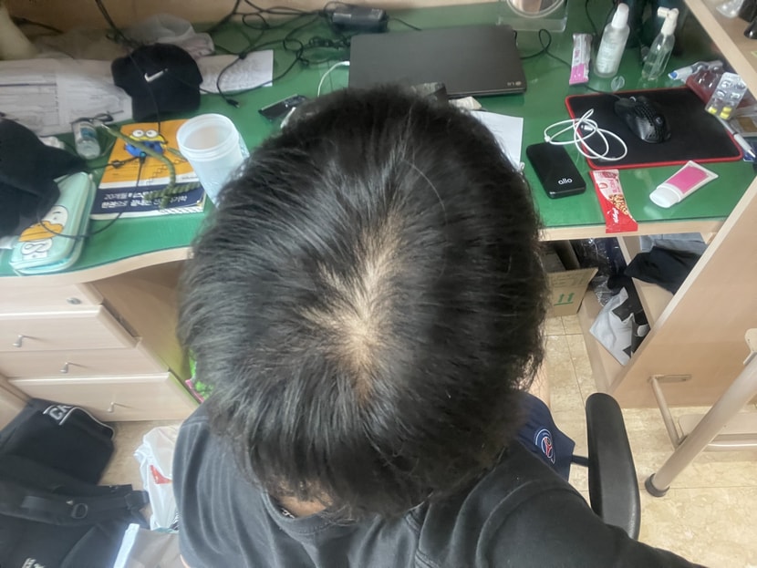 현재 약복용 9개월차2(23년 5월)