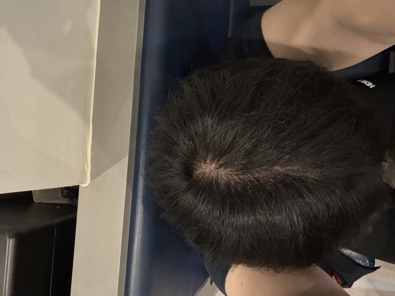 정수리 어때 보이나요