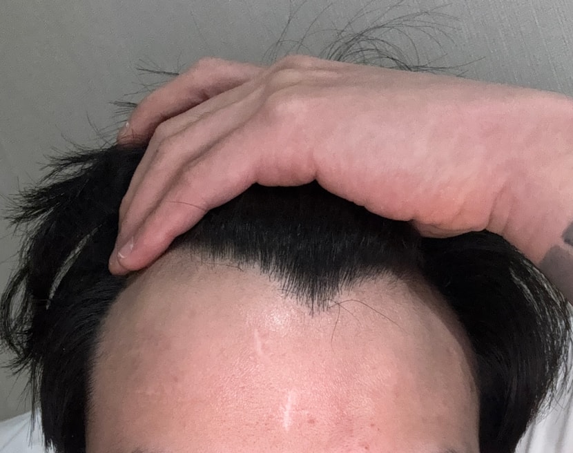 혹시 진행많이된건가요 이정도면..?