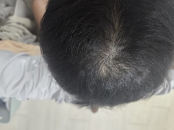 안젖은머리