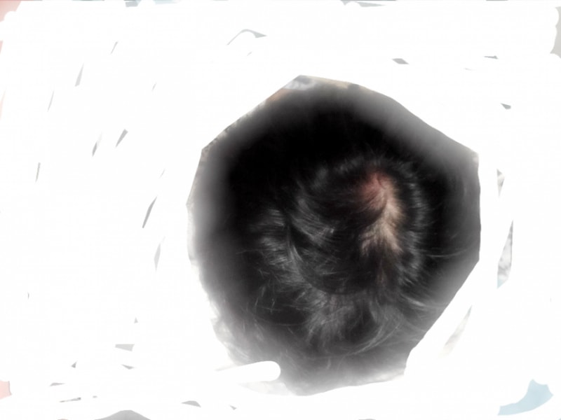 정수리 판별 한번 부탁드립니다.